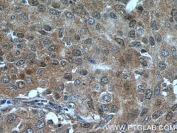PRMT5 Rabbit anti-Human, Mouse, Polyclonal, Proteintech 150 &mu;L; Unconjugated:Antibodies,