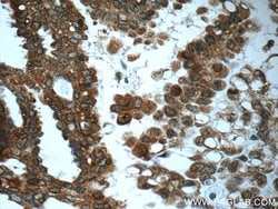 PRMT5 Rabbit anti-Human, Mouse, Polyclonal, Proteintech 150 &mu;L; Unconjugated:Antibodies,