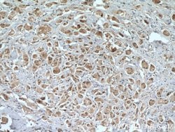 PRMT5 Rabbit anti-Human, Mouse, Polyclonal, Proteintech 150 &mu;L; Unconjugated:Antibodies,