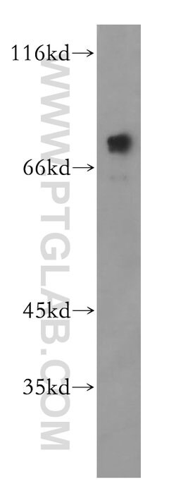 PRMT5 Rabbit anti-Human, Mouse, Polyclonal, Proteintech 150 &mu;L; Unconjugated:Antibodies,