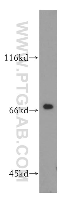 PRMT5 Rabbit anti-Human, Mouse, Polyclonal, Proteintech 150 &mu;L; Unconjugated:Antibodies,