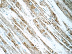 UQCRFS1 Rabbit anti-Human, Mouse, Rat, Polyclonal, Proteintech 150 &mu;L;