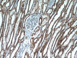 UQCRFS1 Rabbit anti-Human, Mouse, Rat, Polyclonal, Proteintech 150 &mu;L;