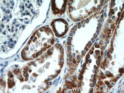 UQCRFS1 Rabbit anti-Human, Mouse, Rat, Polyclonal, Proteintech 150 &mu;L;