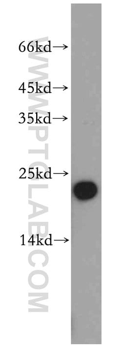UQCRFS1 Rabbit anti-Human, Mouse, Rat, Polyclonal, Proteintech 150 &mu;L;