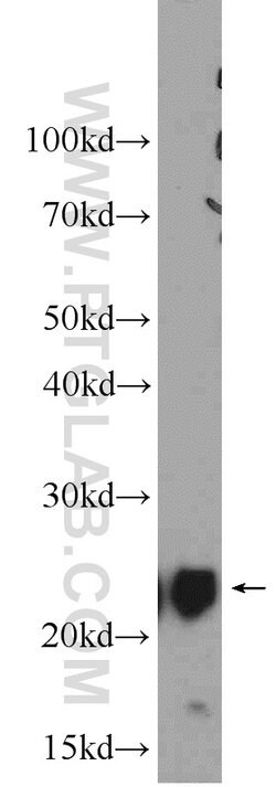 UQCRFS1 Rabbit anti-Human, Mouse, Rat, Polyclonal, Proteintech 150 &mu;L;