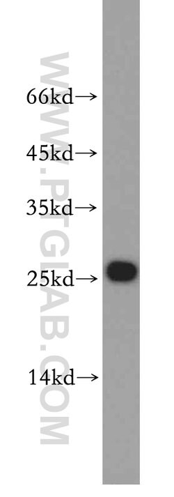 UQCRFS1 Rabbit anti-Human, Mouse, Rat, Polyclonal, Proteintech 150 &mu;L;