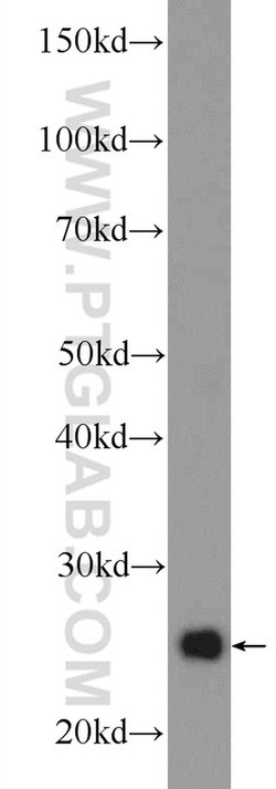 UQCRFS1 Rabbit anti-Human, Mouse, Rat, Polyclonal, Proteintech 150 &mu;L;