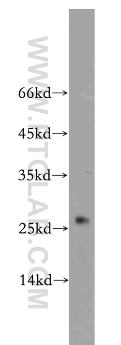 UQCRFS1 Rabbit anti-Human, Mouse, Rat, Polyclonal, Proteintech 150 &mu;L;