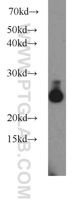 UQCRFS1 Rabbit anti-Human, Mouse, Rat, Polyclonal, Proteintech 150 &mu;L;