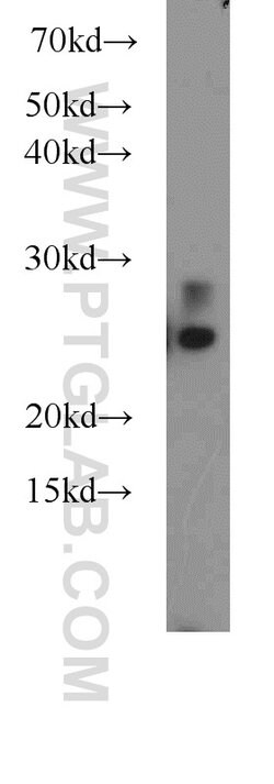 UQCRFS1 Rabbit anti-Human, Mouse, Rat, Polyclonal, Proteintech 150 &mu;L;