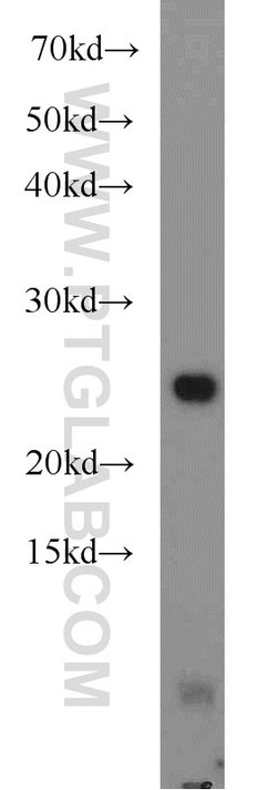 UQCRFS1 Rabbit anti-Human, Mouse, Rat, Polyclonal, Proteintech 150 &mu;L;