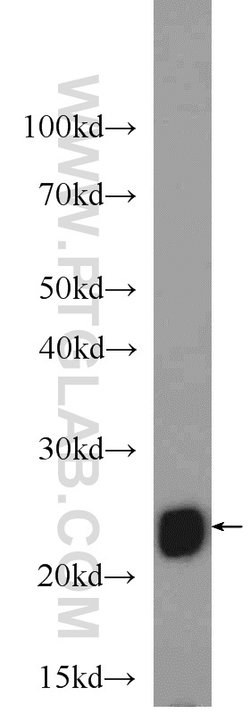 UQCRFS1 Rabbit anti-Human, Mouse, Rat, Polyclonal, Proteintech 150 &mu;L;