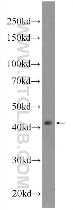 IKBKG Rabbit anti-Human, Mouse, Rat, Polyclonal, Proteintech 150 &mu;L;