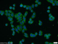 IKBKG Rabbit anti-Human, Mouse, Rat, Polyclonal, Proteintech 150 &mu;L;