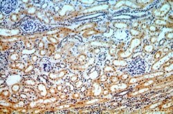 IKBKG Rabbit anti-Human, Mouse, Rat, Polyclonal, Proteintech 150 &mu;L;