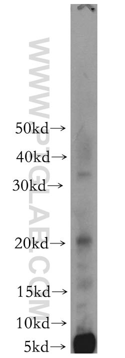 PPP1R14B Rabbit anti-Human, Mouse, Rat, Polyclonal, Proteintech 150 &mu;L;
