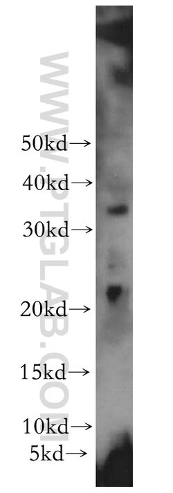 PPP1R14B Rabbit anti-Human, Mouse, Rat, Polyclonal, Proteintech 150 &mu;L;