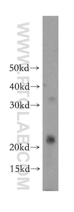PPP1R14B Rabbit anti-Human, Mouse, Rat, Polyclonal, Proteintech 150 &mu;L;