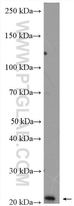 PPP1R14B Rabbit anti-Human, Mouse, Rat, Polyclonal, Proteintech 150 &mu;L;