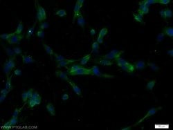 IGFBP4 Rabbit anti-Human, Rat, Polyclonal, Proteintech 150 &mu;L; Unconjugated:Antibodies,
