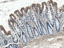 IGFBP4 Rabbit anti-Human, Rat, Polyclonal, Proteintech 150 &mu;L; Unconjugated:Antibodies,