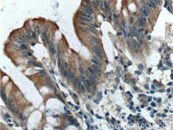 IGFBP4 Rabbit anti-Human, Rat, Polyclonal, Proteintech 150 &mu;L; Unconjugated:Antibodies,