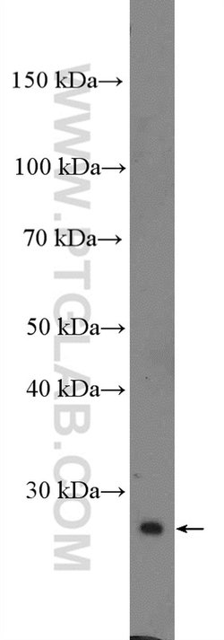IGFBP4 Rabbit anti-Human, Rat, Polyclonal, Proteintech 150 &mu;L; Unconjugated:Antibodies,