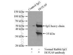 HOXA9 Rabbit anti-Human, Mouse, Rat, Polyclonal, Proteintech 150 &mu;L;