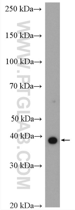 HOXA9 Rabbit anti-Human, Mouse, Rat, Polyclonal, Proteintech 150 &mu;L;