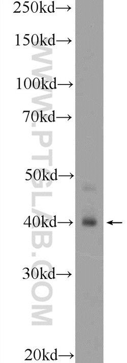 HOXA9 Rabbit anti-Human, Mouse, Rat, Polyclonal, Proteintech 150 &mu;L;