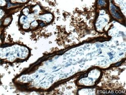 ALPPL2 Rabbit anti-Human, Mouse, Rat, Polyclonal, Proteintech:Antibodies:Primary