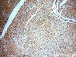 SH2D2A Rabbit anti-Human, Polyclonal, Proteintech:Antibodies:Primary Antibodies