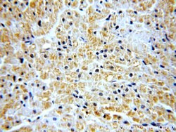 SH2D2A Rabbit anti-Human, Polyclonal, Proteintech:Antibodies:Primary Antibodies