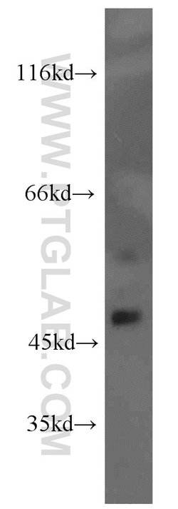 SH2D2A Rabbit anti-Human, Polyclonal, Proteintech:Antibodies:Primary Antibodies