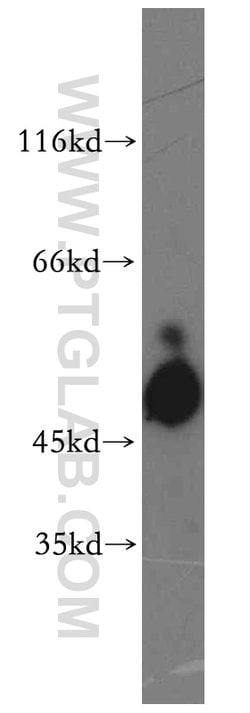 SH2D2A Rabbit anti-Human, Polyclonal, Proteintech:Antibodies:Primary Antibodies