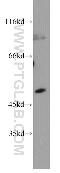 SH2D2A Rabbit anti-Human, Polyclonal, Proteintech:Antibodies:Primary Antibodies