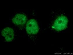 CBX4 Rabbit anti-Human, Mouse, Rat, Polyclonal, Proteintech 20 &mu;L; Unconjugated:Antibodies,