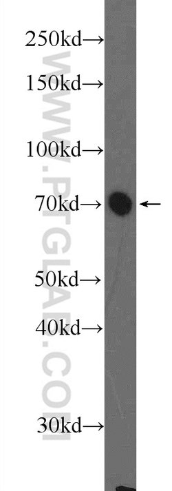 CBX4 Rabbit anti-Human, Mouse, Rat, Polyclonal, Proteintech 20 &mu;L; Unconjugated:Antibodies,