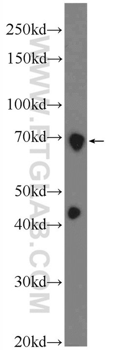 CBX4 Rabbit anti-Human, Mouse, Rat, Polyclonal, Proteintech 20 &mu;L; Unconjugated:Antibodies,