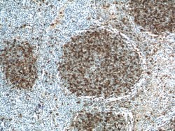 CD23 Rabbit anti-Human, Polyclonal, Proteintech:Antibodies:Primary Antibodies