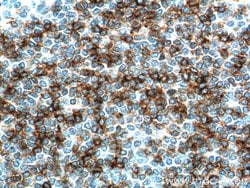 CD23 Rabbit anti-Human, Polyclonal, Proteintech:Antibodies:Primary Antibodies