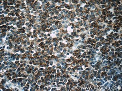 CD23 Rabbit anti-Human, Polyclonal, Proteintech:Antibodies:Primary Antibodies