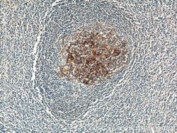 CD23 Rabbit anti-Human, Polyclonal, Proteintech:Antibodies:Primary Antibodies