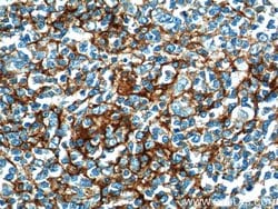 CD23 Rabbit anti-Human, Polyclonal, Proteintech:Antibodies:Primary Antibodies