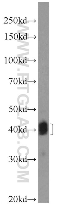 CD23 Rabbit anti-Human, Polyclonal, Proteintech:Antibodies:Primary Antibodies