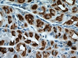 ATP4B Rabbit anti-Human, Mouse, Rat, Polyclonal, Proteintech:Anticuerpos:Anticuerpos