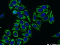 LSS Rabbit anti-Human, Mouse, Rat, Polyclonal, Proteintech 150 &mu;L; Unconjugated:Antibodies,