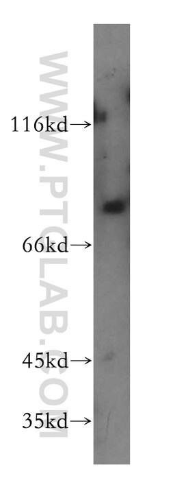 LSS Rabbit anti-Human, Mouse, Rat, Polyclonal, Proteintech 150 &mu;L; Unconjugated:Antibodies,