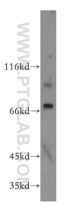 LSS Rabbit anti-Human, Mouse, Rat, Polyclonal, Proteintech 150 &mu;L; Unconjugated:Antibodies,